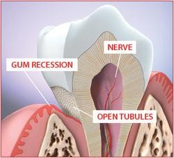 tooth structure